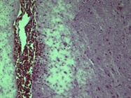 Frozen Mouse Brain Immunohistology