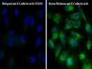 Mouse mAb Against E-Cadherin