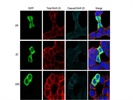 This anti-SNAP-25 is Good Antibody