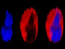 Anti-Neutrophil Elastase Antibody