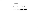 Anti-Histone H3 (Tri Methyl K9) Antibody Abcam Review