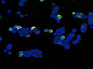 Anti-MMP9 Antibody Detect Real Signal
