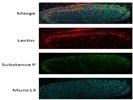 Anti-Munc13 Is Good Antibody