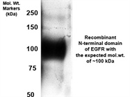 Anti-EGFR Rabbit Antibody PB9016 from Boster against the N-terminus of EGFR