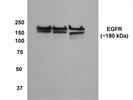 Mouse mAb sc-374607 against EGFR from Santa Cruz