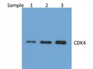 A Decent Antibody For CDK4 Analysis