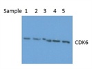 A Decent Antibody For CDK6 Analysis
