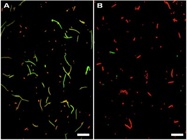 Qualitative Microscopy Analysis Of Bacterial Viability Over Time