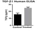 Human TGF beta 1 ELISA