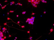 Anti-beta III Tubulin (Immunofluorescence)
