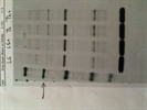 Phosphorylated IRE1alpha