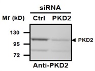 PKD2 Antibody For Western Blot