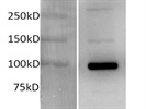 HDAC9 Antibody From Novus - Western Blotting