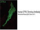Anti CFTR Antibody For Fluorescence And Western Blotting