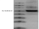ß-Arrestin 1/2 from Cell Signaling is a Good Antibody to Use