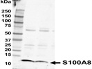 Anti-MRP8 Antibody