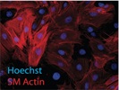 Anti-alpha Actin (1A4) [Immunofluorescence]