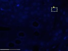 PALM Laser Capture Microdissection System Review