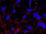 Excellent anti-SNAP25 antibody