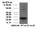 Western Blot Using Anti-HMOX1 Antibody (PB9212)