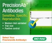 Validated Western Blotting Antibodies That Work Every Time