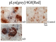 ABC Kit For Visible Chromogen