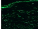 Mouse Skin CD11b IF Staining
