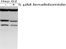 Review For Anti-Ikaros Antibody