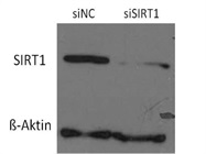 SIRT1 Western Blot Using Primary CD4+ T-Cells