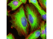 Fluorescent Peptides: Valuable Tools for Medical Research