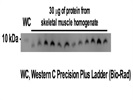 PLN In Mouse Skeletal Muscle