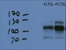 Good Detection In Leukemia Cells