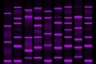 Protein Stains: Tried, True and Not Just Blue