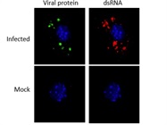 Anti-dsRNA Antibody