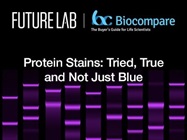Protein Stains: Tried, True and Not Just Blue