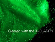 A journey through a Thy1-YFP mouse brain