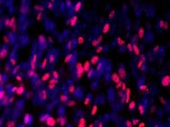Use Of Ki67 polyclonal Antibody From Abcam On Myogenic Cell Culture