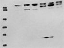 Average Antibody For VEGF Receptor 3 (FLT4)