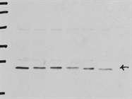 Highly Specific Abcam FGF-2 Antibody