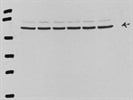 Good Quality PAK1 Antibody From Abcam