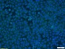 VDAC Fluorescent Microscopy