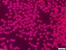 IP3R Immunofluorescence