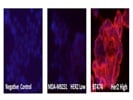 HER2/Neu MAb From Santa Cruz For Immunocytochemistry
