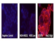 HER2/Neu MAb From Santa Cruz For Immunocytochemistry