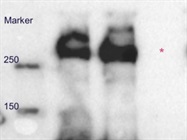 Anti-ATR antibody for Western blotting