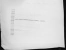 Aldose Reductase In Rat Lens
