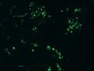Mouse Skin Desmin/Pericyte