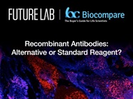 Recombinant Antibodies: Alternative or Standard Reagent