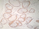 Excellent Application In IHC