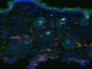 Pericyte Staining In Mouse Skin